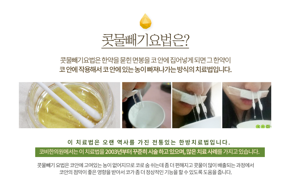 콧물빼기요법은 한약을 묻힌 면봉을 코 안에 집어넣게 되면 그 한약이 코 안에 작용해서 코 안에 있는 농이 빠져나가는 방식의 치료법입니다. 